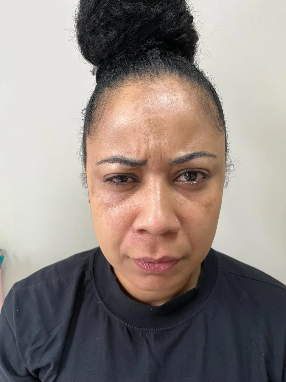 Antes – registro 1