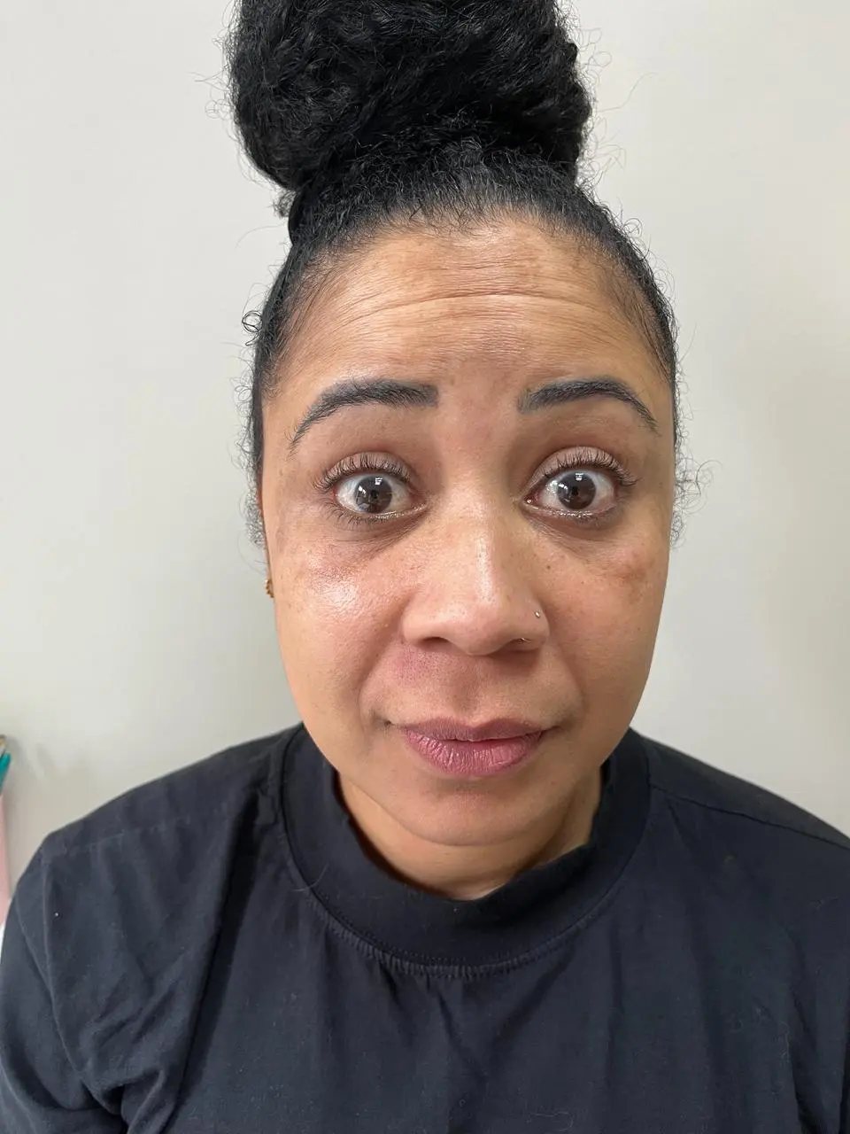 Antes – registro 2