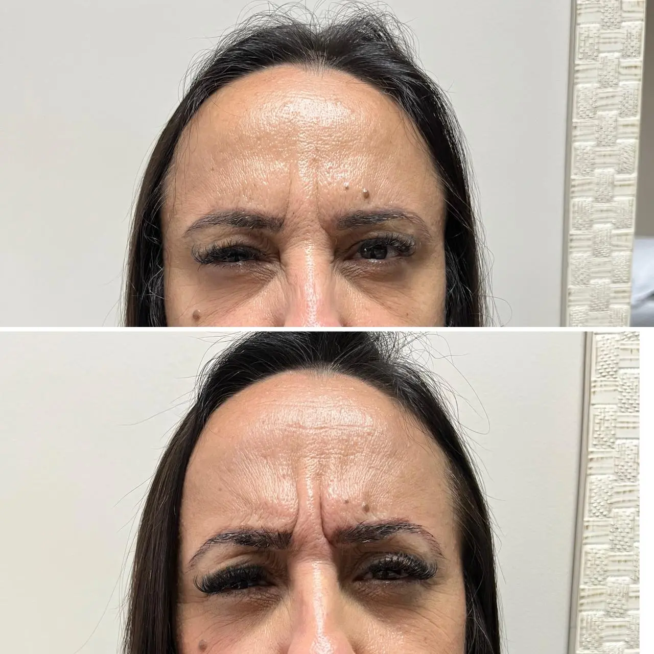 Resultado estético – antes e depois 5