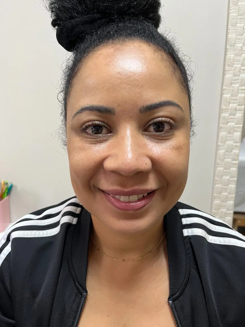 Depois – registro 2