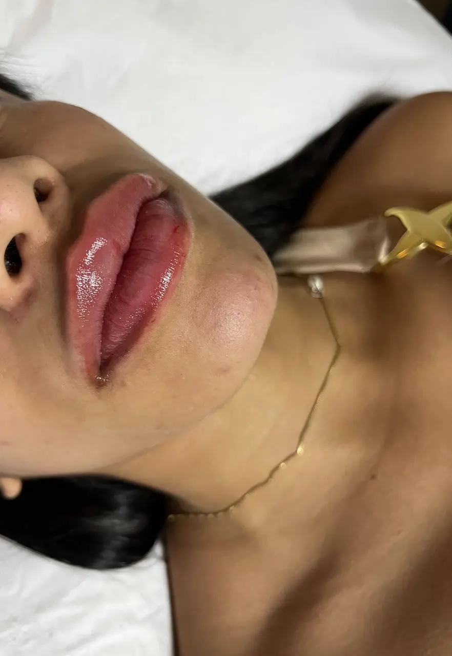 Resultado – foto final 2